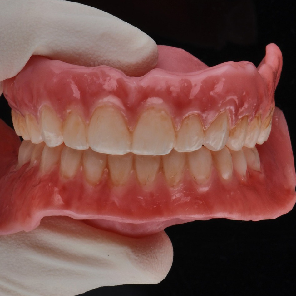 Riabilitazione Full Mouth
